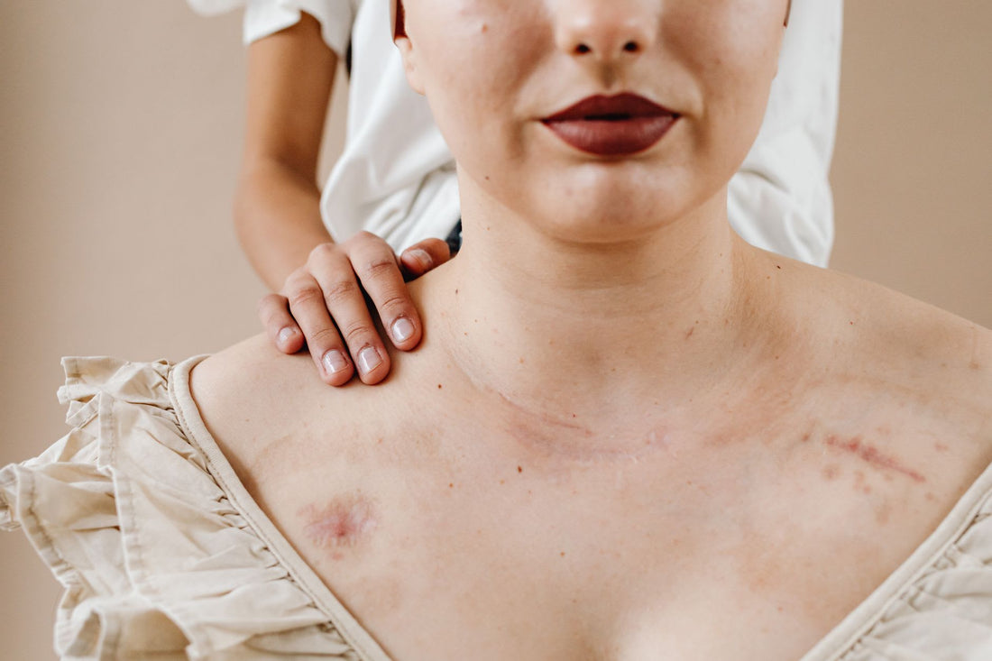 How To Let Go Of Trauma Stored In The Body