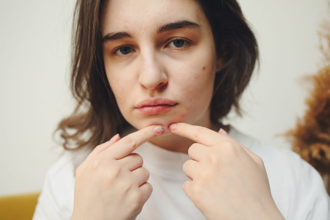 Psychology Behind Watching Pimple Popping